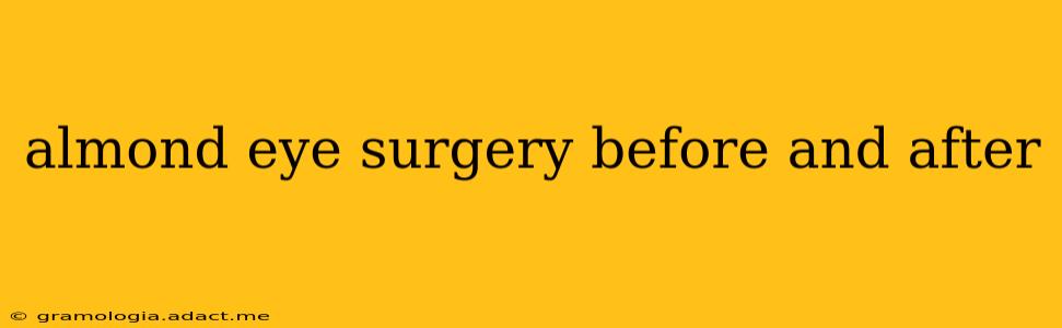 almond eye surgery before and after