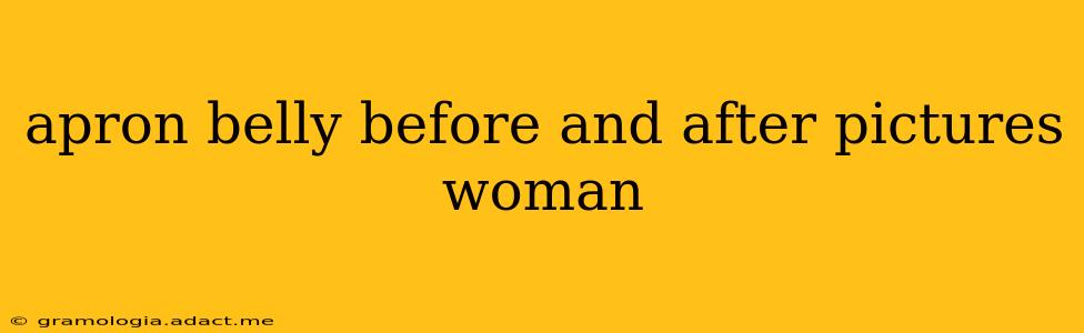 apron belly before and after pictures woman