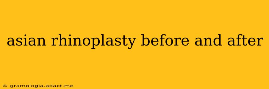 asian rhinoplasty before and after