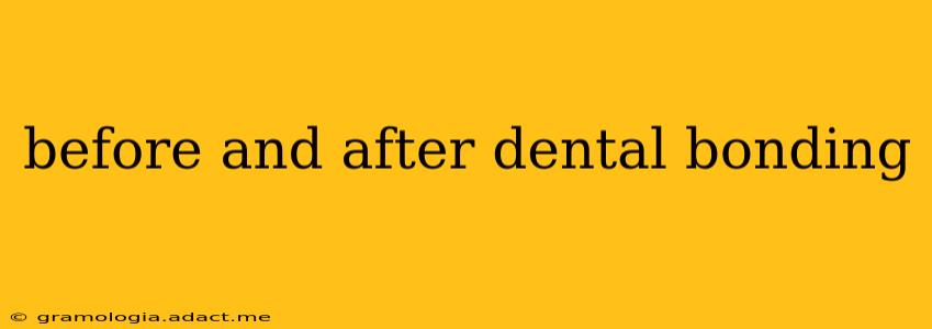 before and after dental bonding