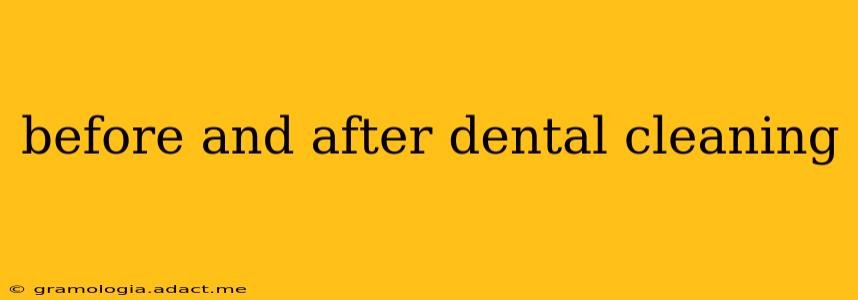 before and after dental cleaning