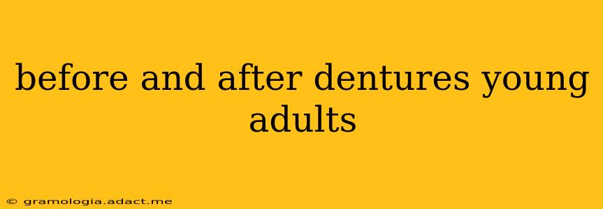before and after dentures young adults