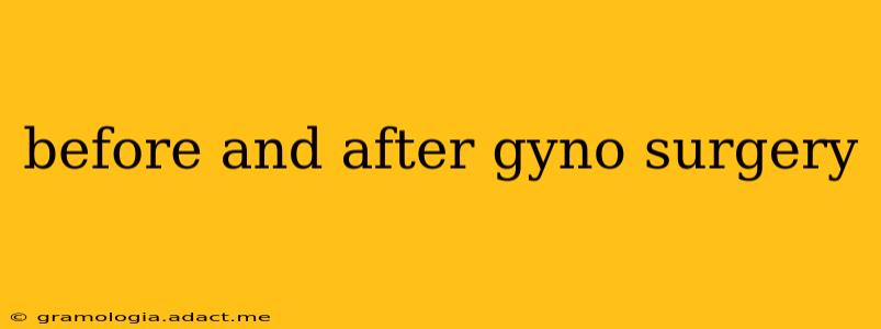 before and after gyno surgery