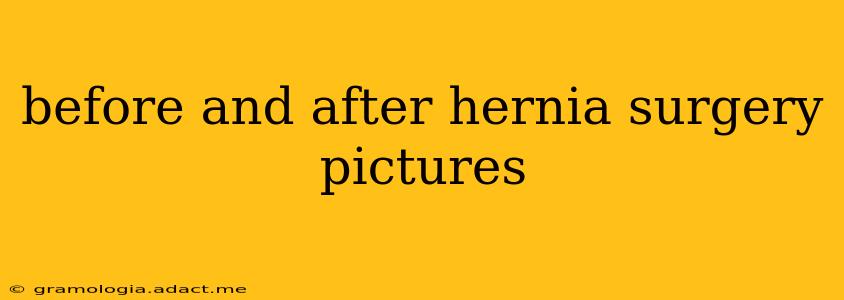 before and after hernia surgery pictures