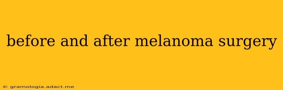 before and after melanoma surgery