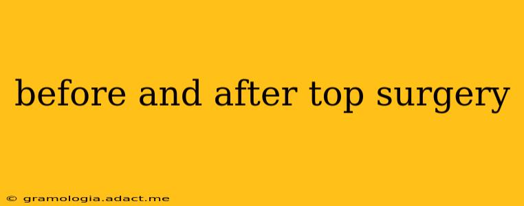 before and after top surgery