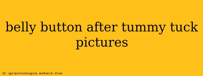 belly button after tummy tuck pictures