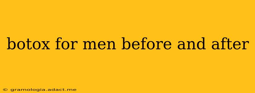 botox for men before and after