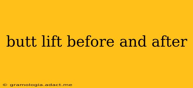butt lift before and after