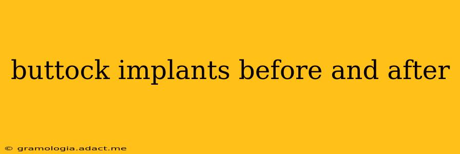 buttock implants before and after