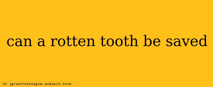 can a rotten tooth be saved