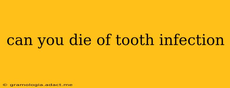 can you die of tooth infection