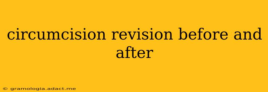 circumcision revision before and after