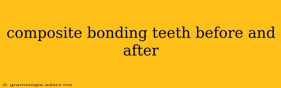 composite bonding teeth before and after