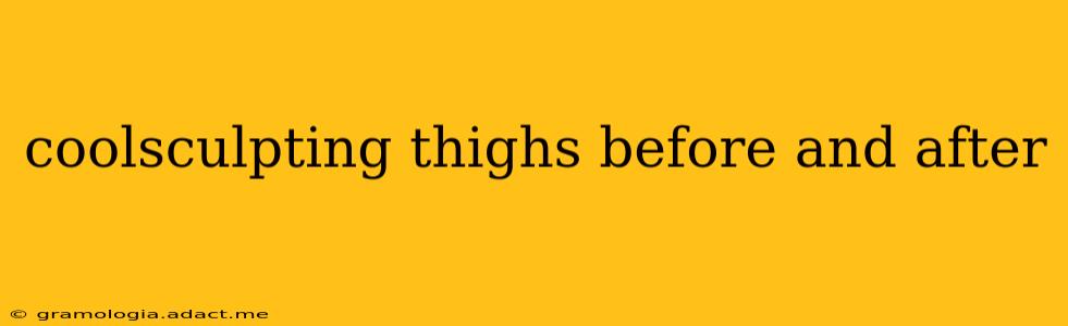coolsculpting thighs before and after