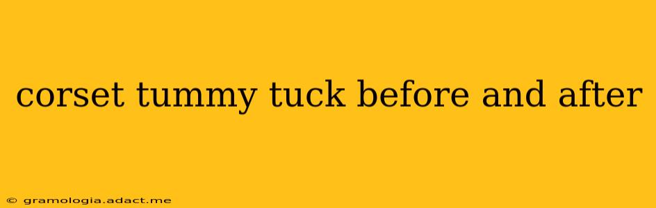 corset tummy tuck before and after