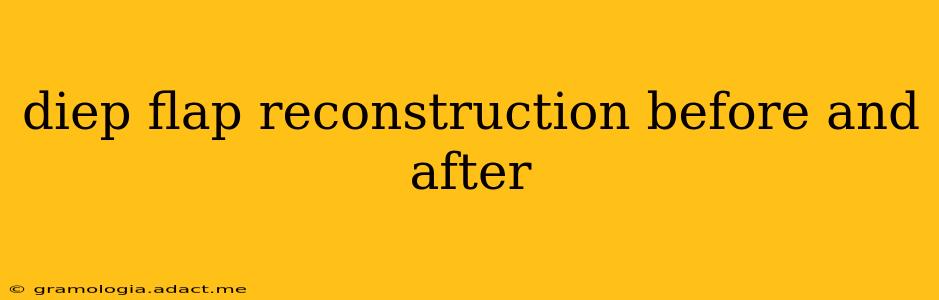 diep flap reconstruction before and after