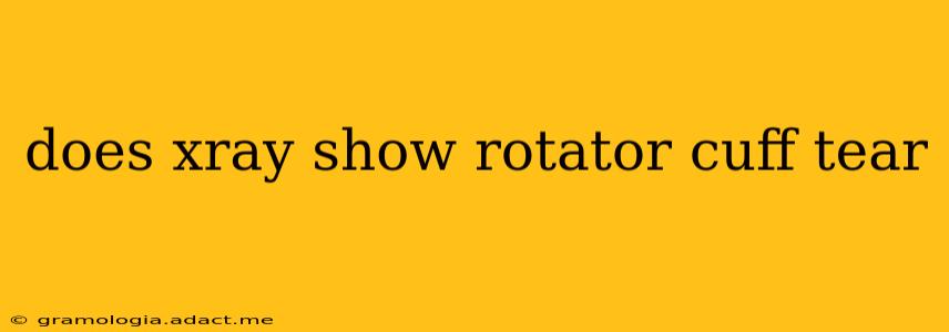 does xray show rotator cuff tear