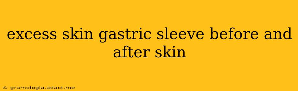 excess skin gastric sleeve before and after skin
