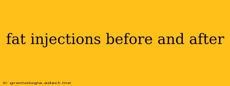 fat injections before and after