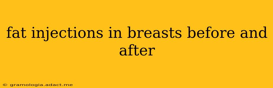 fat injections in breasts before and after