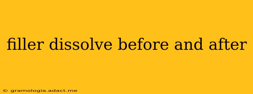 filler dissolve before and after