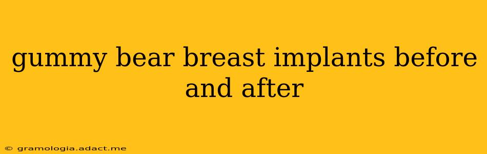 gummy bear breast implants before and after