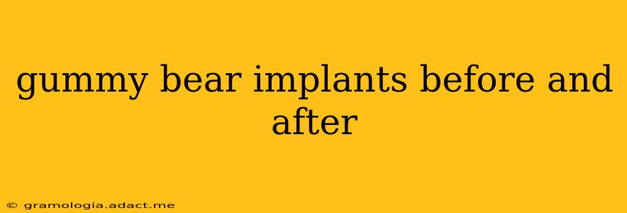 gummy bear implants before and after