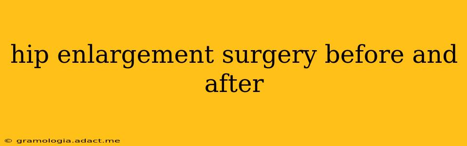 hip enlargement surgery before and after