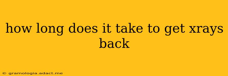 how long does it take to get xrays back