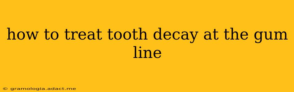 how to treat tooth decay at the gum line