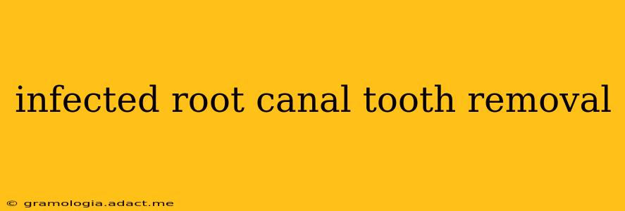 infected root canal tooth removal