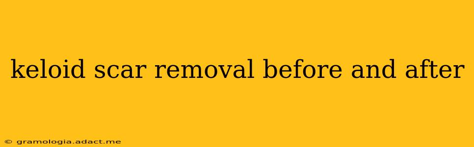 keloid scar removal before and after