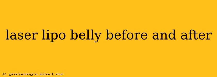 laser lipo belly before and after