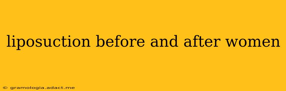 liposuction before and after women