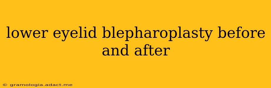 lower eyelid blepharoplasty before and after