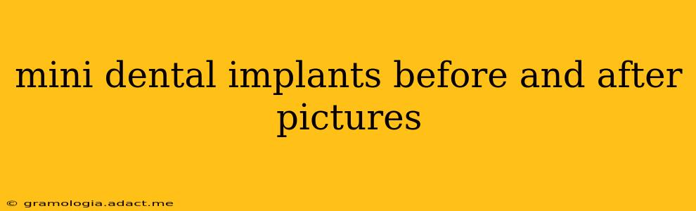 mini dental implants before and after pictures