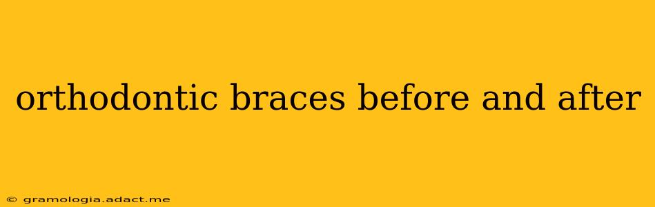 orthodontic braces before and after