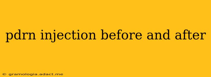 pdrn injection before and after