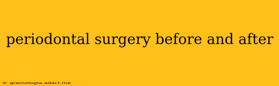 periodontal surgery before and after