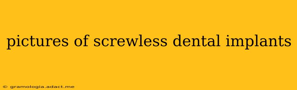 pictures of screwless dental implants