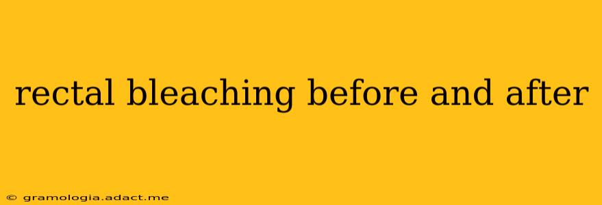 rectal bleaching before and after