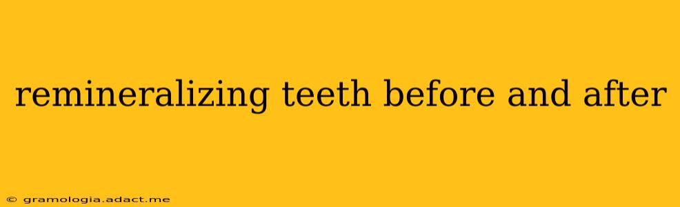 remineralizing teeth before and after