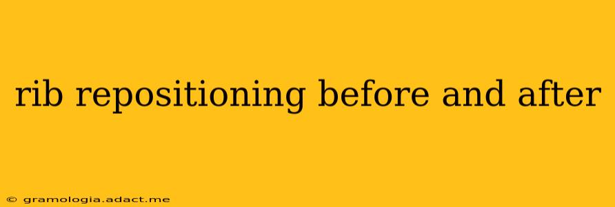 rib repositioning before and after