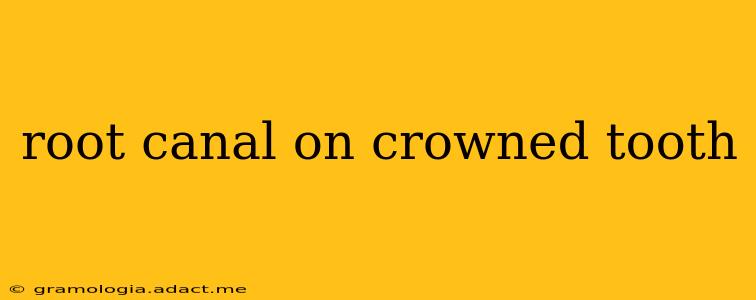 root canal on crowned tooth