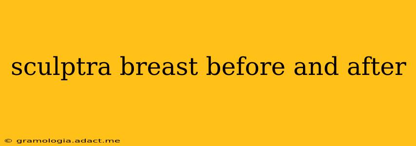sculptra breast before and after