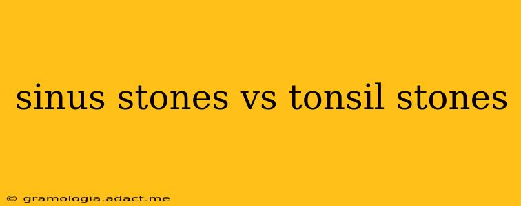 sinus stones vs tonsil stones