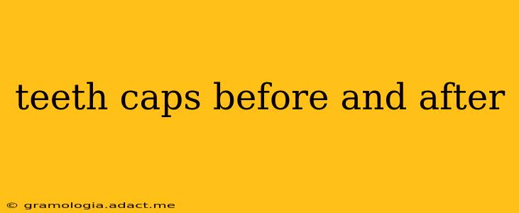 teeth caps before and after