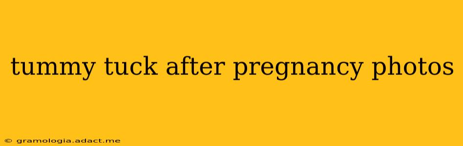 tummy tuck after pregnancy photos