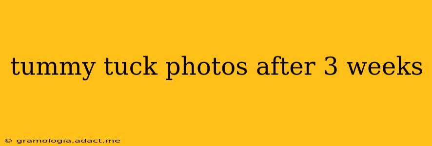 tummy tuck photos after 3 weeks